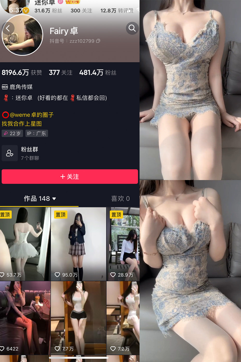 抖音 卓 微密圈 NO.011期 【4P1V】